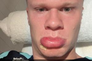 盛世美顏??哈蘭德早起撅香腸嘴曬自拍：早上好??