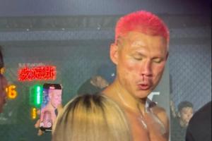 ??骨折了？惡鼠被威姆斯一拳打到面門(mén)！鼻梁已經(jīng)出現(xiàn)嚴(yán)重歪斜！