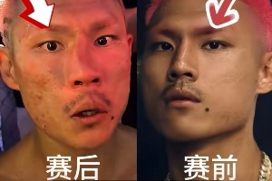 慘遭“整容”！惡鼠遭威姆斯TKO 鼻梁骨被打歪鮮血直流??