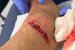 慎入！迪涅腳踝被踩而裁判無表示，換下后怒踢座椅找四官泰勒理論