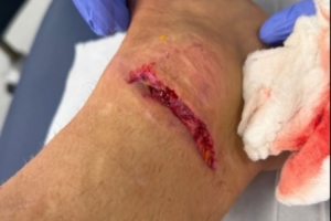 丹索：迪涅在場(chǎng)邊我向他道了歉，確實(shí)碰到了他，但我明顯先清了球