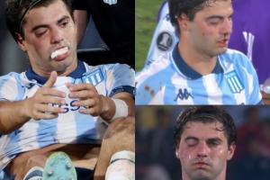 被打懵了！羅霍解放者杯不慎肘擊誤傷隊友，后者眼部腫了鼻子流血