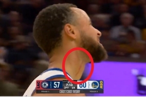 庫里：血痕是之前打湖人那場留下的 看起來要比實(shí)際情況嚴(yán)重