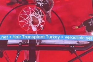 問啥詹姆斯！NBA籃板上沿有土耳其植發(fā)公司廣告 手動(dòng)@杰倫-布朗