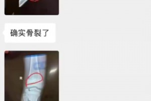 孫繼海無辜！你這媽不是因?yàn)楹⒆邮軅磐顺觯侨ギ?dāng)?shù)氐木銟凡? >
                                        </div>
                                    </div>
                                                                        <div   id=